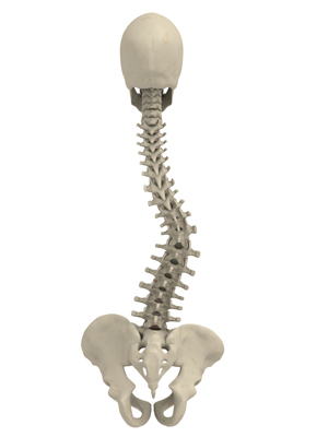 Scoliosis Info and Solutions - lumbar scoliosis of the spine chairs